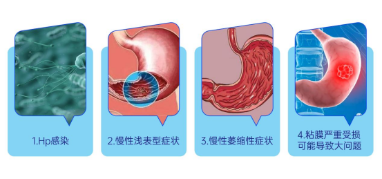 中国幽门螺杆菌感染排全球第一！后生元Postbiocare®在靶向抗幽护胃赛道大显作用