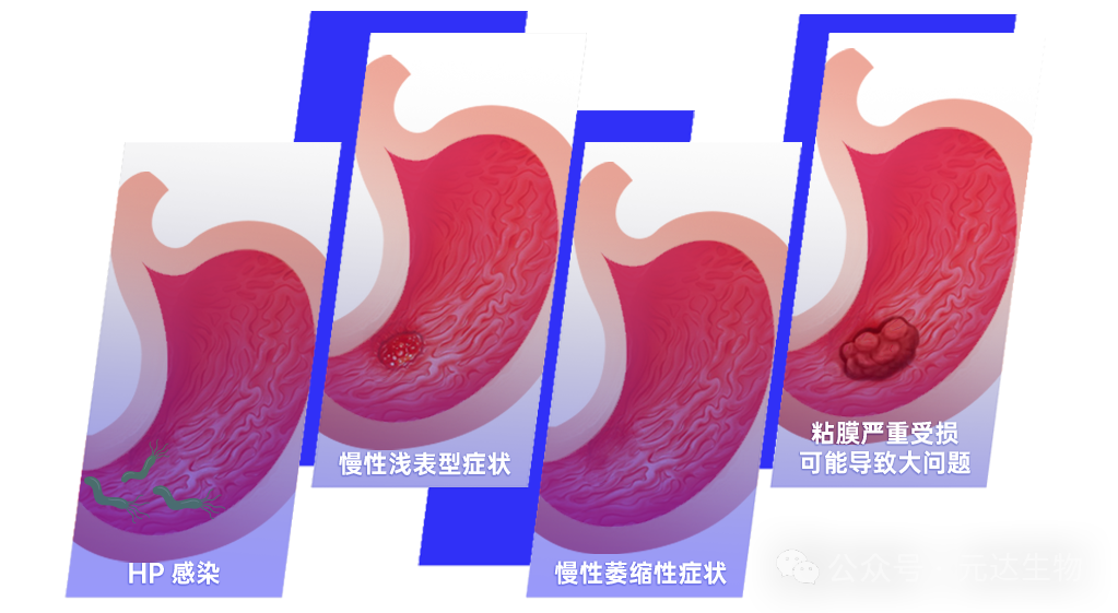 《柳叶刀》发布抗幽新疗法!后生元带来更温和的“养胃”选择